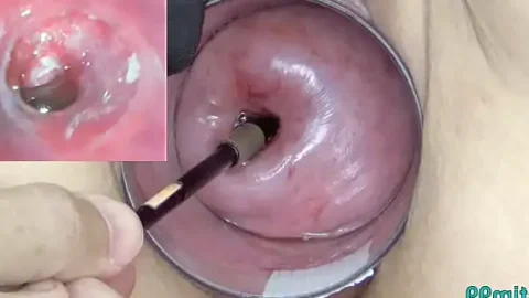 mature milf cervix play with endoscope japanese cam into uterus 1733319021